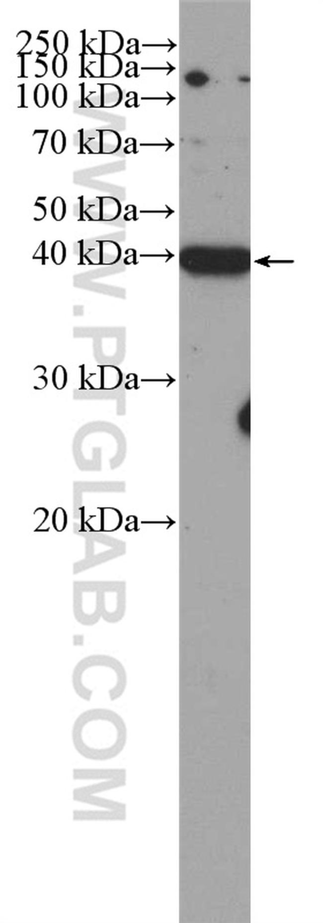 CDK5R2/p39 Antibody in Western Blot (WB)