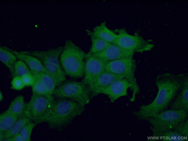 TRAIL Antibody in Immunocytochemistry (ICC/IF)