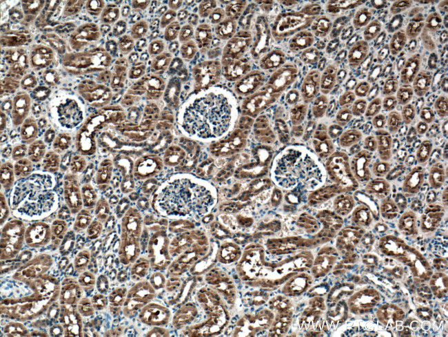 TRAIL Antibody in Immunohistochemistry (Paraffin) (IHC (P))