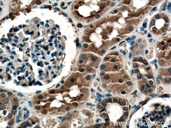 TRAIL Antibody in Immunohistochemistry (Paraffin) (IHC (P))