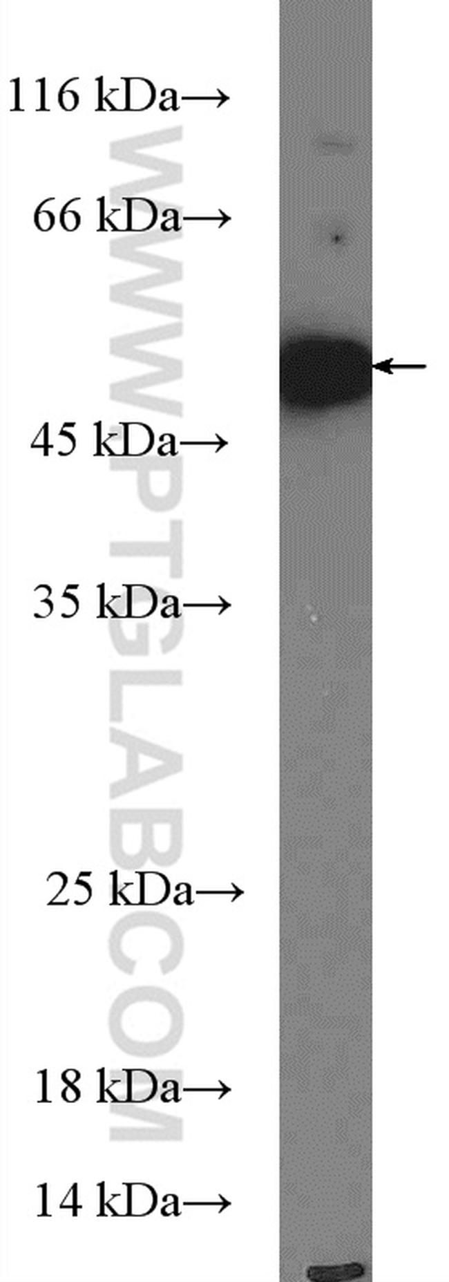 TANK Antibody in Western Blot (WB)