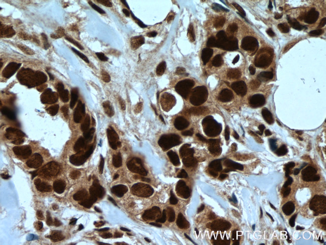 RAD21 Antibody in Immunohistochemistry (Paraffin) (IHC (P))