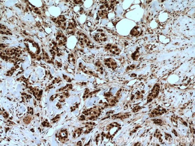 RAD21 Antibody in Immunohistochemistry (Paraffin) (IHC (P))