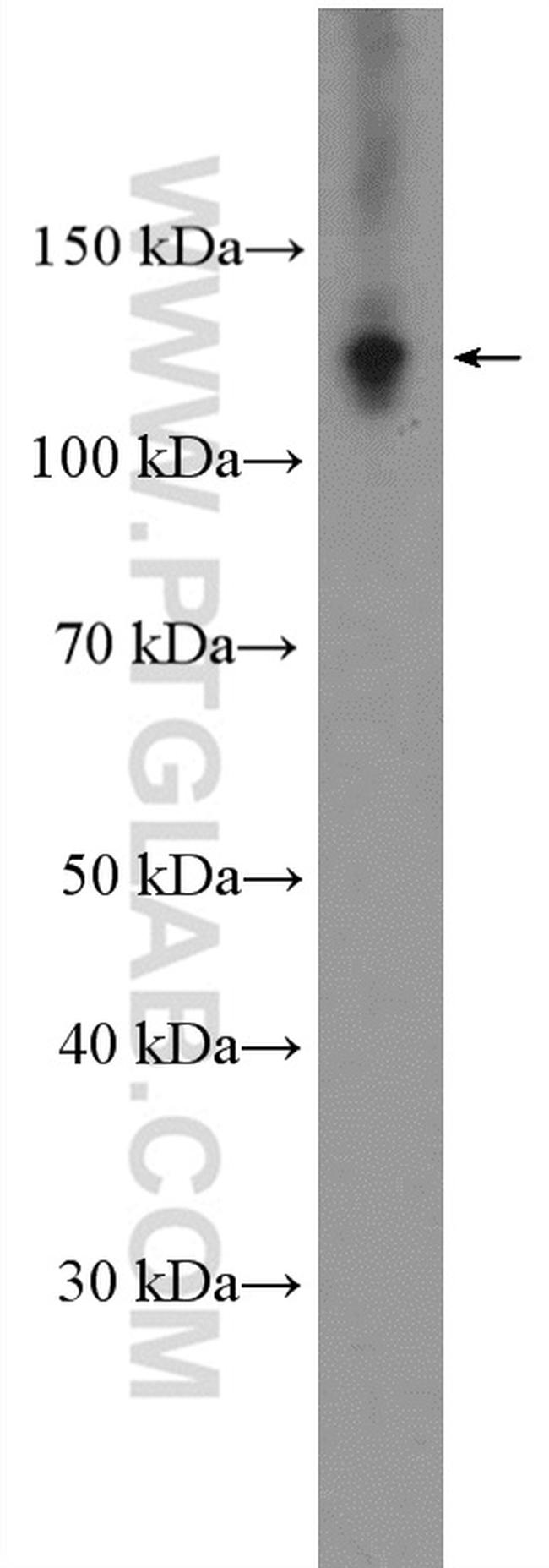 RAD21 Antibody in Western Blot (WB)