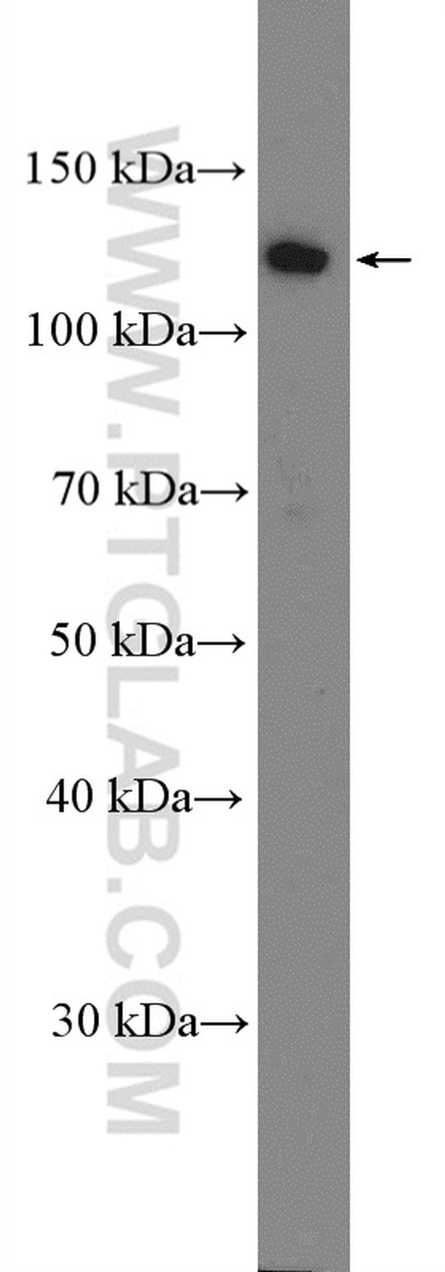 RAD21 Antibody in Western Blot (WB)