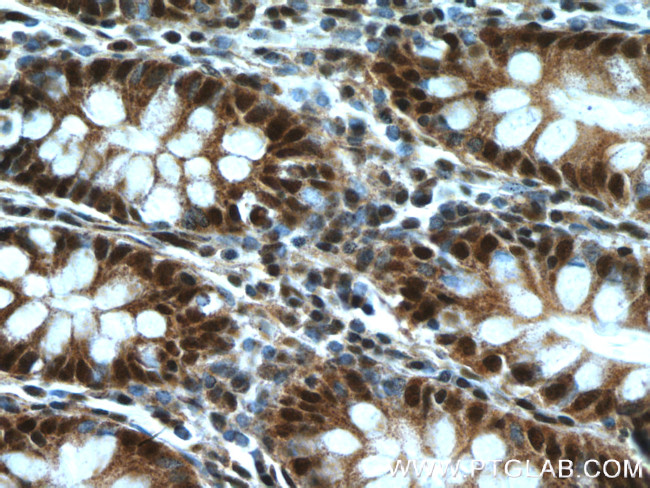 BUB3 Antibody in Immunohistochemistry (Paraffin) (IHC (P))