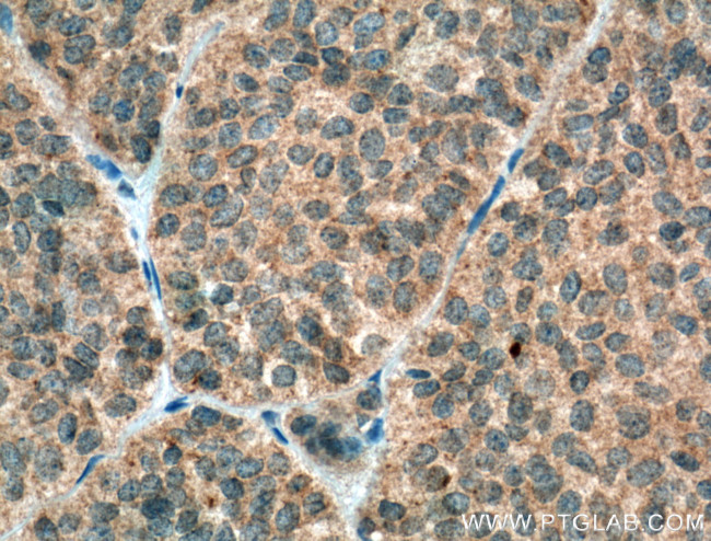 Growth hormone Antibody in Immunohistochemistry (Paraffin) (IHC (P))