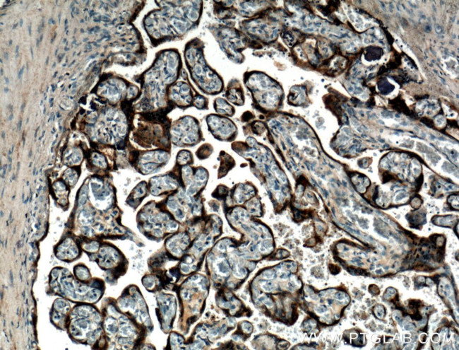 Growth hormone Antibody in Immunohistochemistry (Paraffin) (IHC (P))