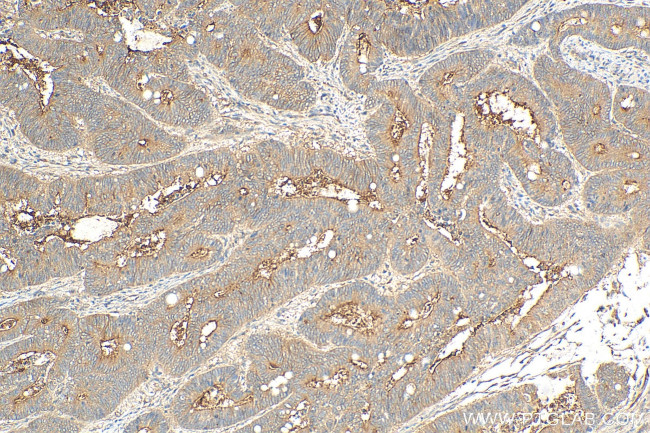 Angiopoietin 1 Antibody in Immunohistochemistry (Paraffin) (IHC (P))