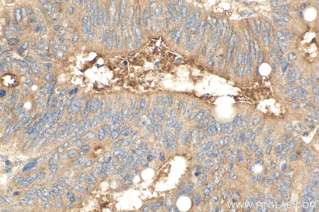 Angiopoietin 1 Antibody in Immunohistochemistry (Paraffin) (IHC (P))