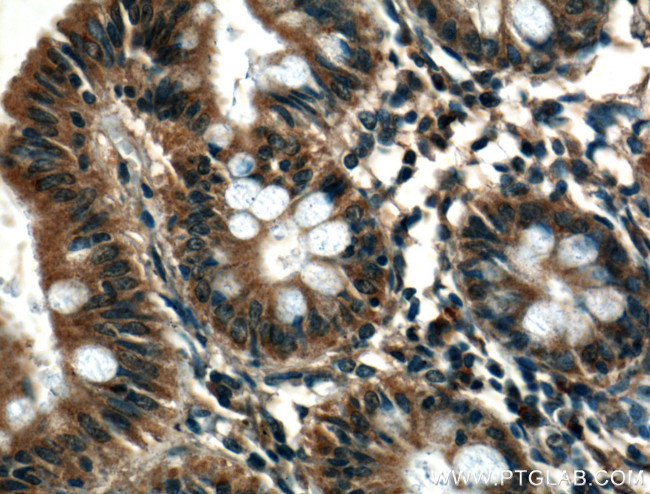 RAB10 Antibody in Immunohistochemistry (Paraffin) (IHC (P))