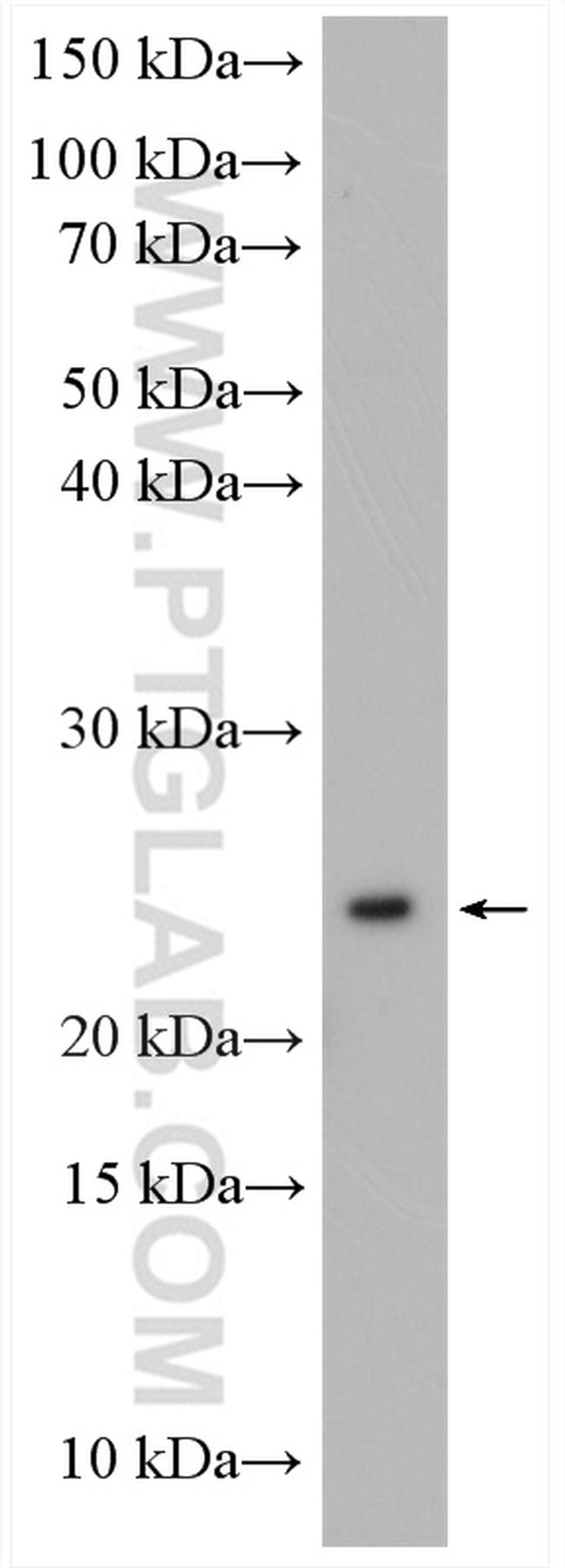 RAB10 Antibody in Western Blot (WB)