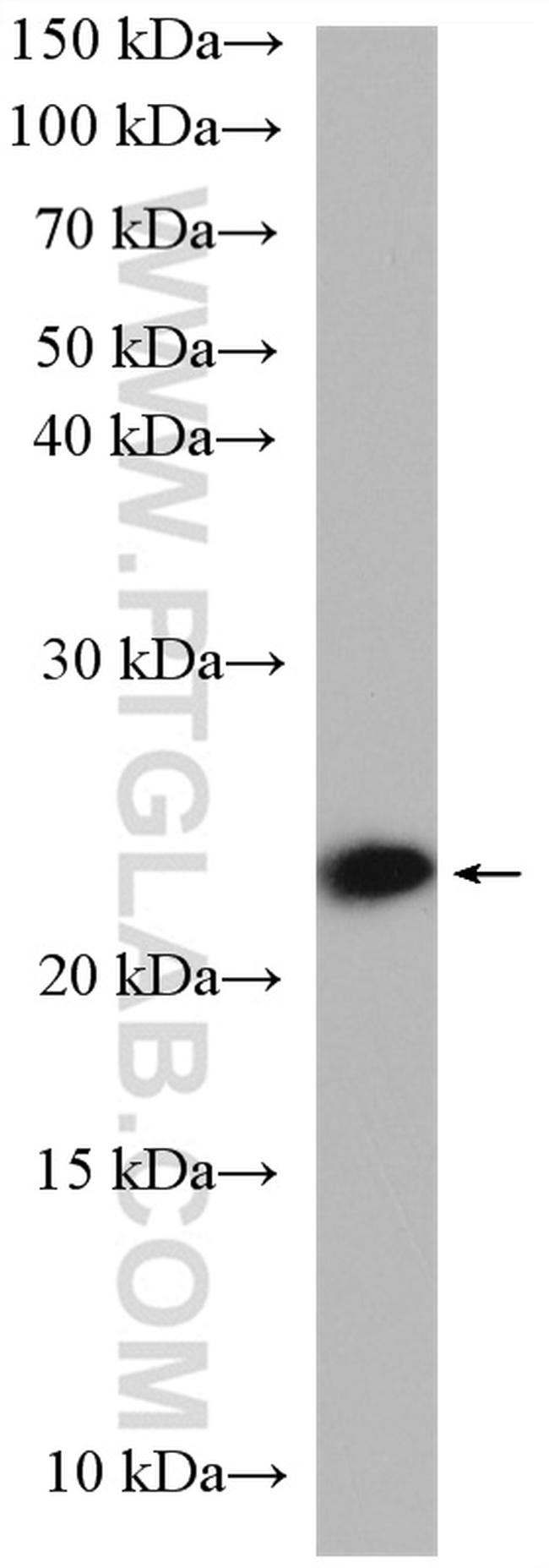 RAB10 Antibody in Western Blot (WB)