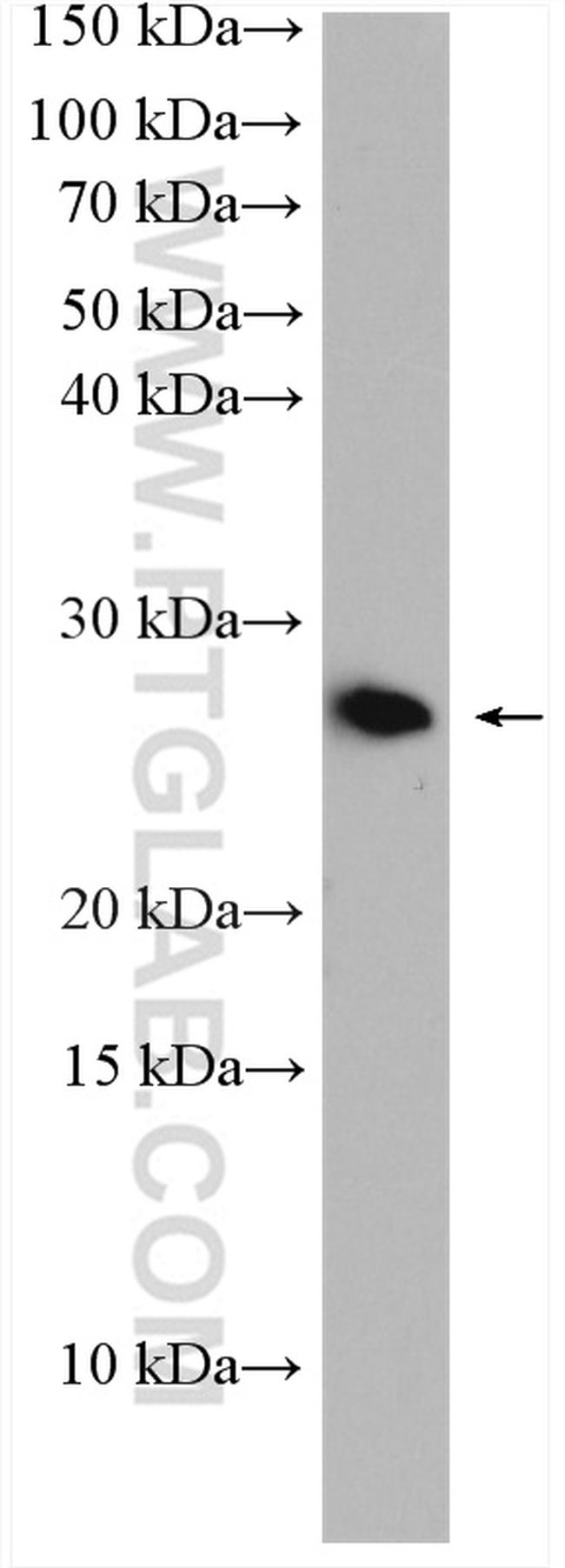 RAB10 Antibody in Western Blot (WB)