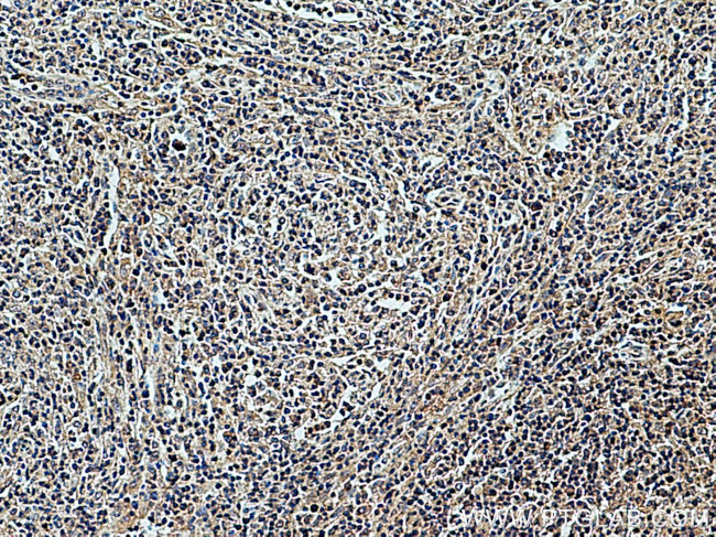 CXCL8/IL8 Antibody in Immunohistochemistry (Paraffin) (IHC (P))