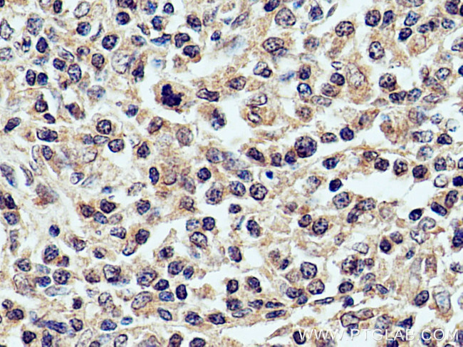 CXCL8/IL8 Antibody in Immunohistochemistry (Paraffin) (IHC (P))