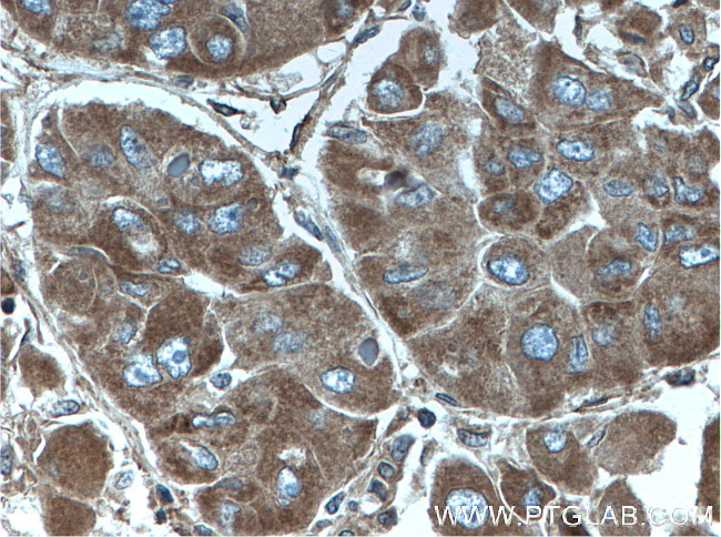 ITGAV Antibody in Immunohistochemistry (Paraffin) (IHC (P))