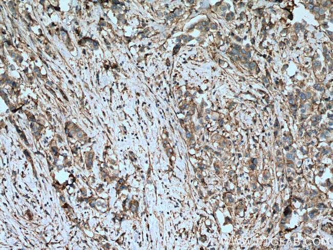 ITGAV Antibody in Immunohistochemistry (Paraffin) (IHC (P))