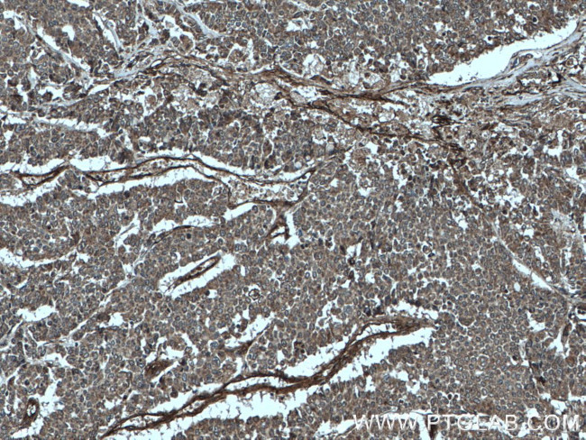 ITGAV Antibody in Immunohistochemistry (Paraffin) (IHC (P))