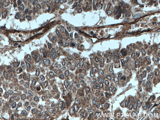 ITGAV Antibody in Immunohistochemistry (Paraffin) (IHC (P))