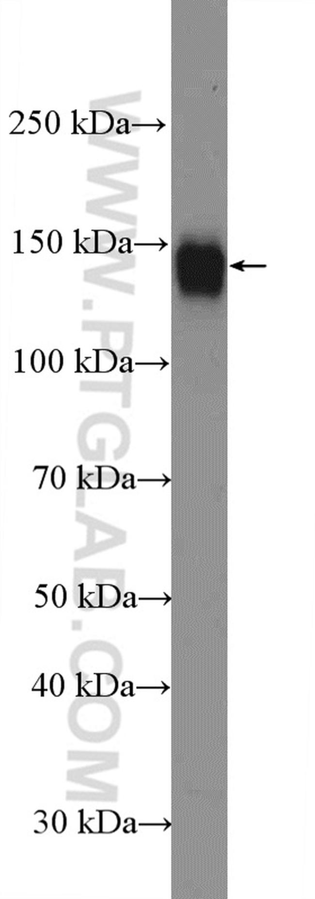 ITGAV Antibody in Western Blot (WB)