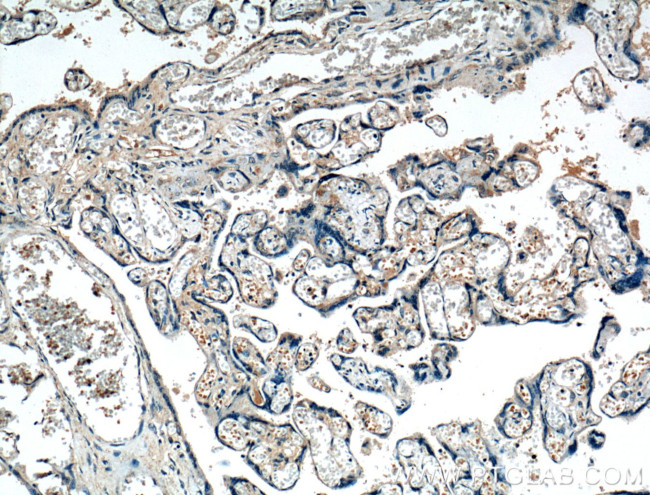 FGF3 Antibody in Immunohistochemistry (Paraffin) (IHC (P))