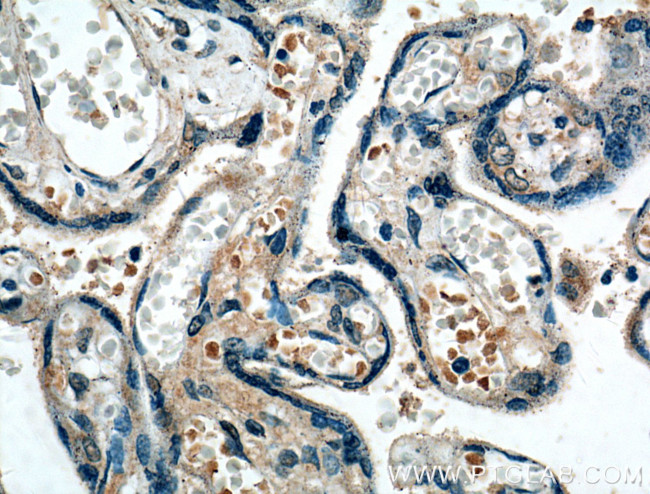 FGF3 Antibody in Immunohistochemistry (Paraffin) (IHC (P))