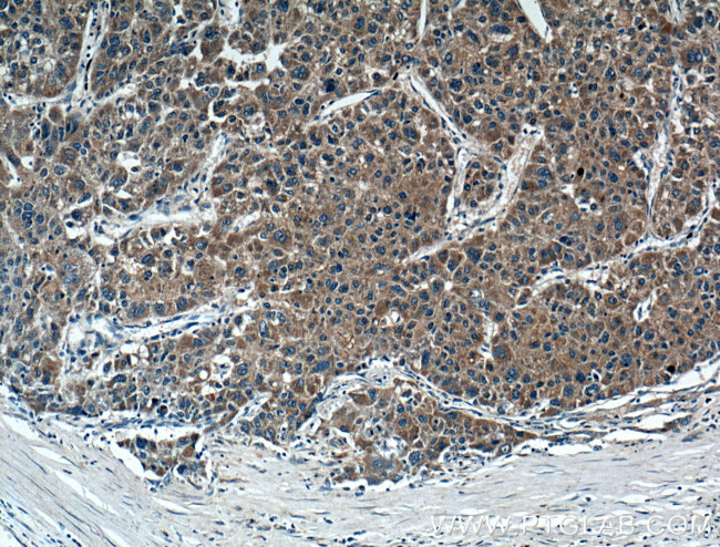 FGF3 Antibody in Immunohistochemistry (Paraffin) (IHC (P))