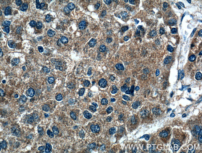 FGF3 Antibody in Immunohistochemistry (Paraffin) (IHC (P))