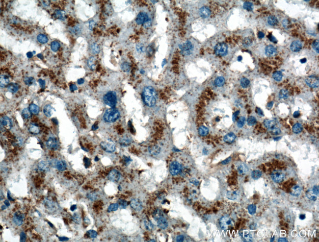 LIMPII Antibody in Immunohistochemistry (Paraffin) (IHC (P))