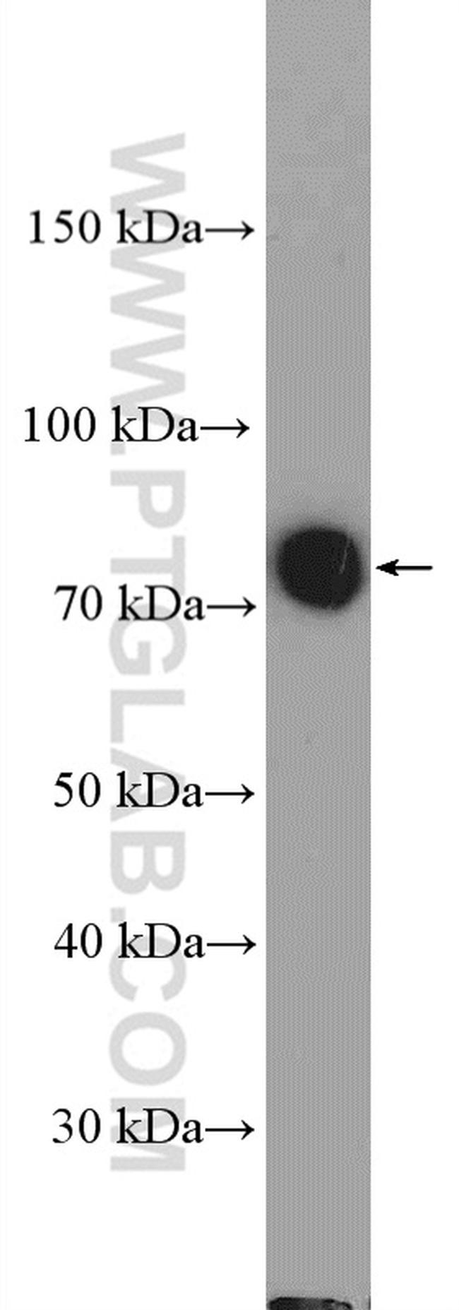 LIMPII Antibody in Western Blot (WB)