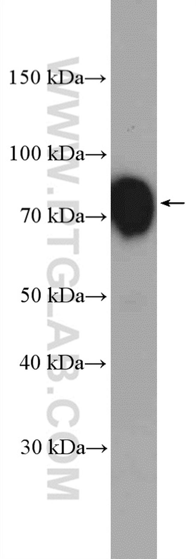 LIMPII Antibody in Western Blot (WB)