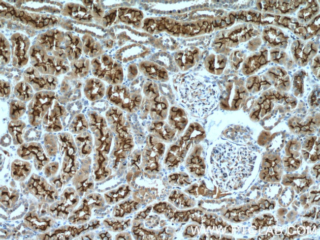 PCDH24 Antibody in Immunohistochemistry (Paraffin) (IHC (P))