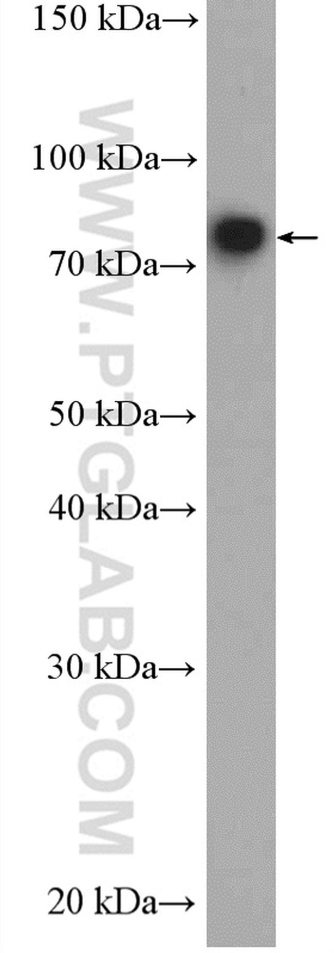 SHCBP1L Antibody in Western Blot (WB)