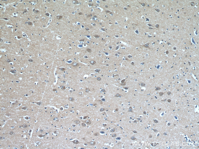 KCNK4 Antibody in Immunohistochemistry (Paraffin) (IHC (P))