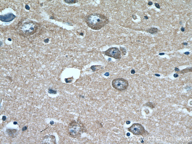 KCNK4 Antibody in Immunohistochemistry (Paraffin) (IHC (P))