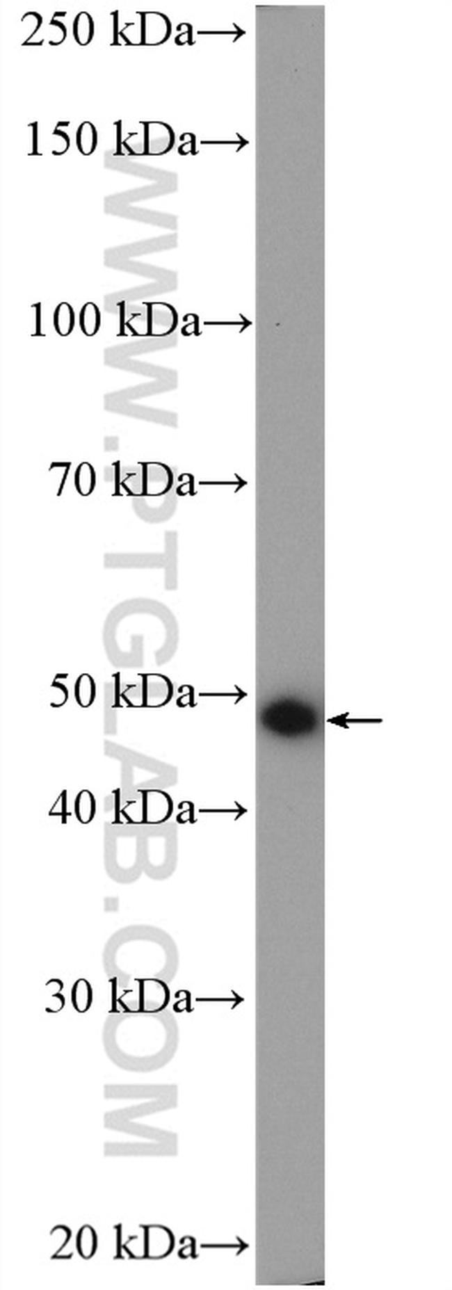 KCNK4 Antibody in Western Blot (WB)