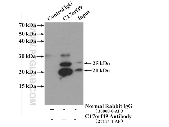 C17orf49 Antibody in Immunoprecipitation (IP)