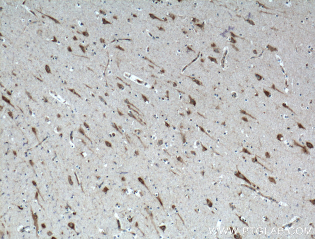 PTN Antibody in Immunohistochemistry (Paraffin) (IHC (P))