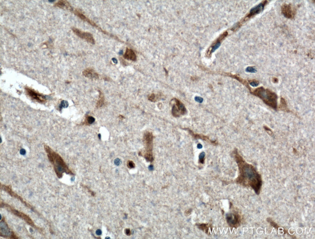 PTN Antibody in Immunohistochemistry (Paraffin) (IHC (P))