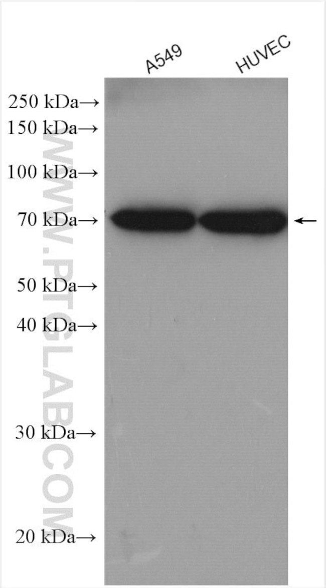 ADAM15 Antibody in Western Blot (WB)