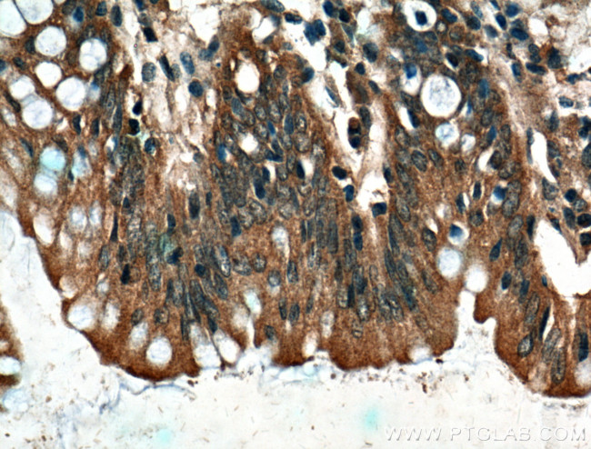 CARMIL Antibody in Immunohistochemistry (Paraffin) (IHC (P))