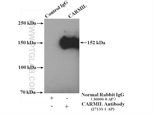 CARMIL Antibody in Immunoprecipitation (IP)