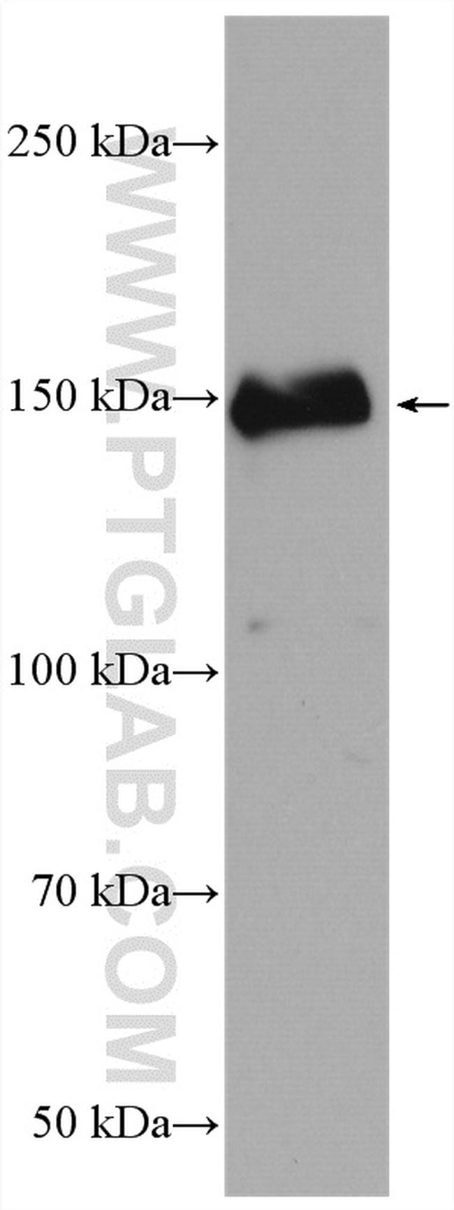 CARMIL Antibody in Western Blot (WB)