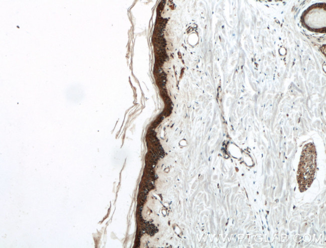 EGF Antibody in Immunohistochemistry (Paraffin) (IHC (P))