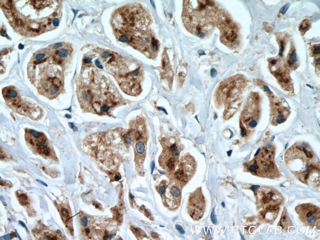 SGSM3 Antibody in Immunohistochemistry (Paraffin) (IHC (P))