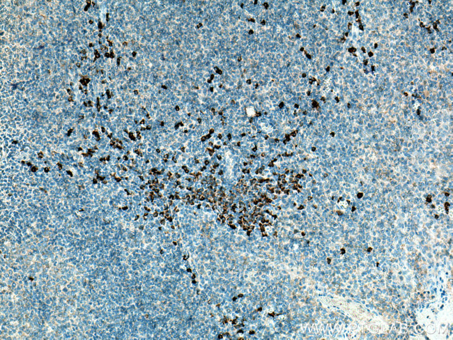 CSF2RB Antibody in Immunohistochemistry (Paraffin) (IHC (P))