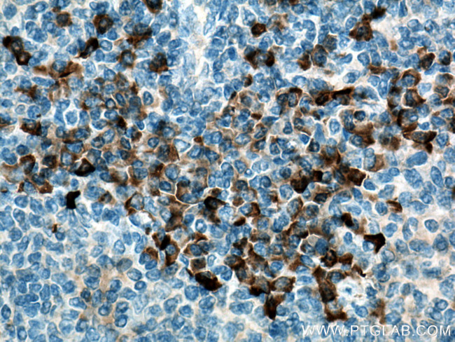 CSF2RB Antibody in Immunohistochemistry (Paraffin) (IHC (P))