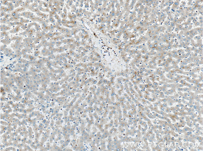 Factor XII Antibody in Immunohistochemistry (Paraffin) (IHC (P))