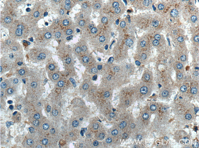 Factor XII Antibody in Immunohistochemistry (Paraffin) (IHC (P))